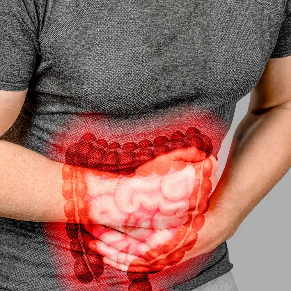 Beyond Symptoms_ How Merus Gastroenterologys 360-Degree Approach Addresses Root Causes of GI Issues