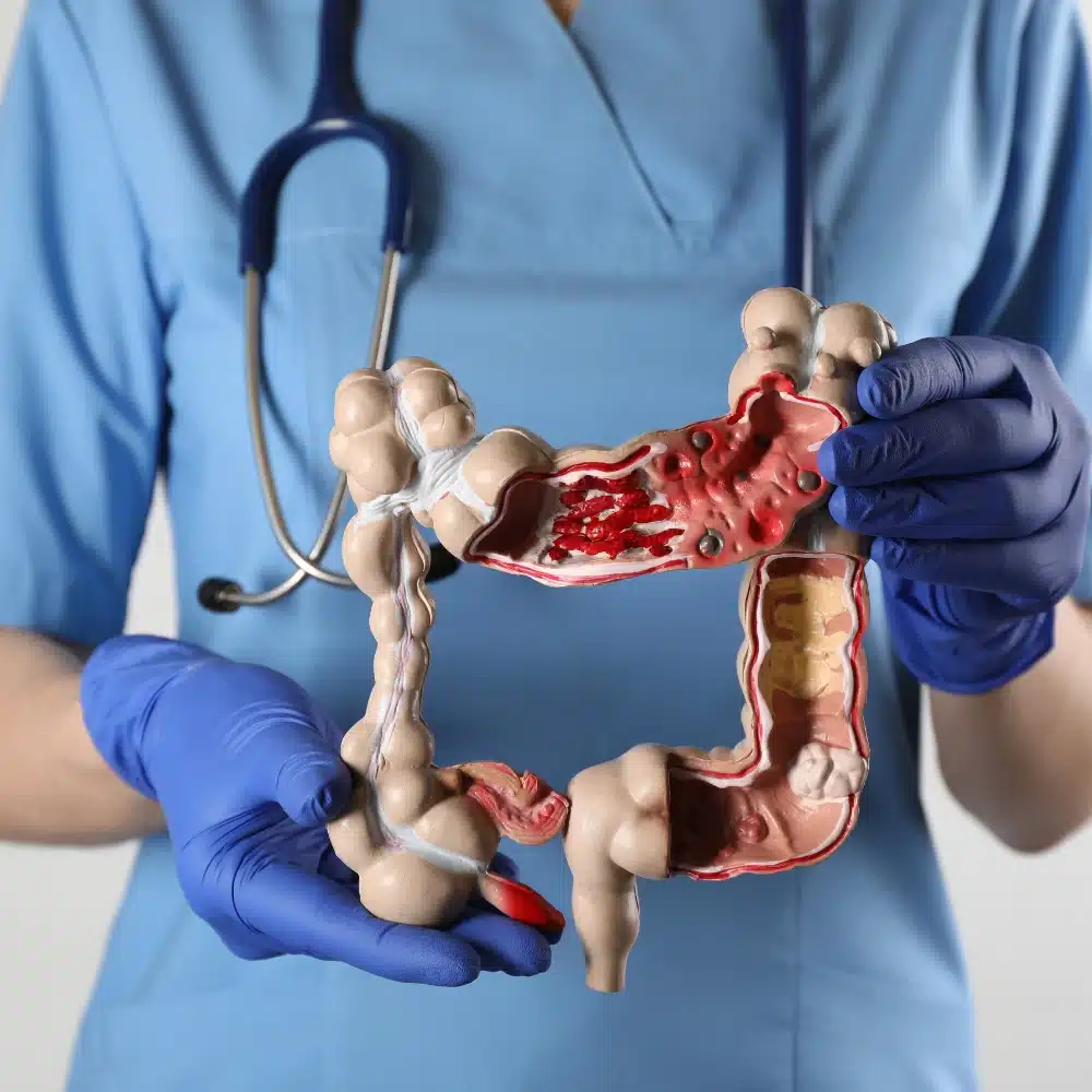 Crohn's Disease doctor consulting patient in Suwanee GA at Merus Gastroenterology