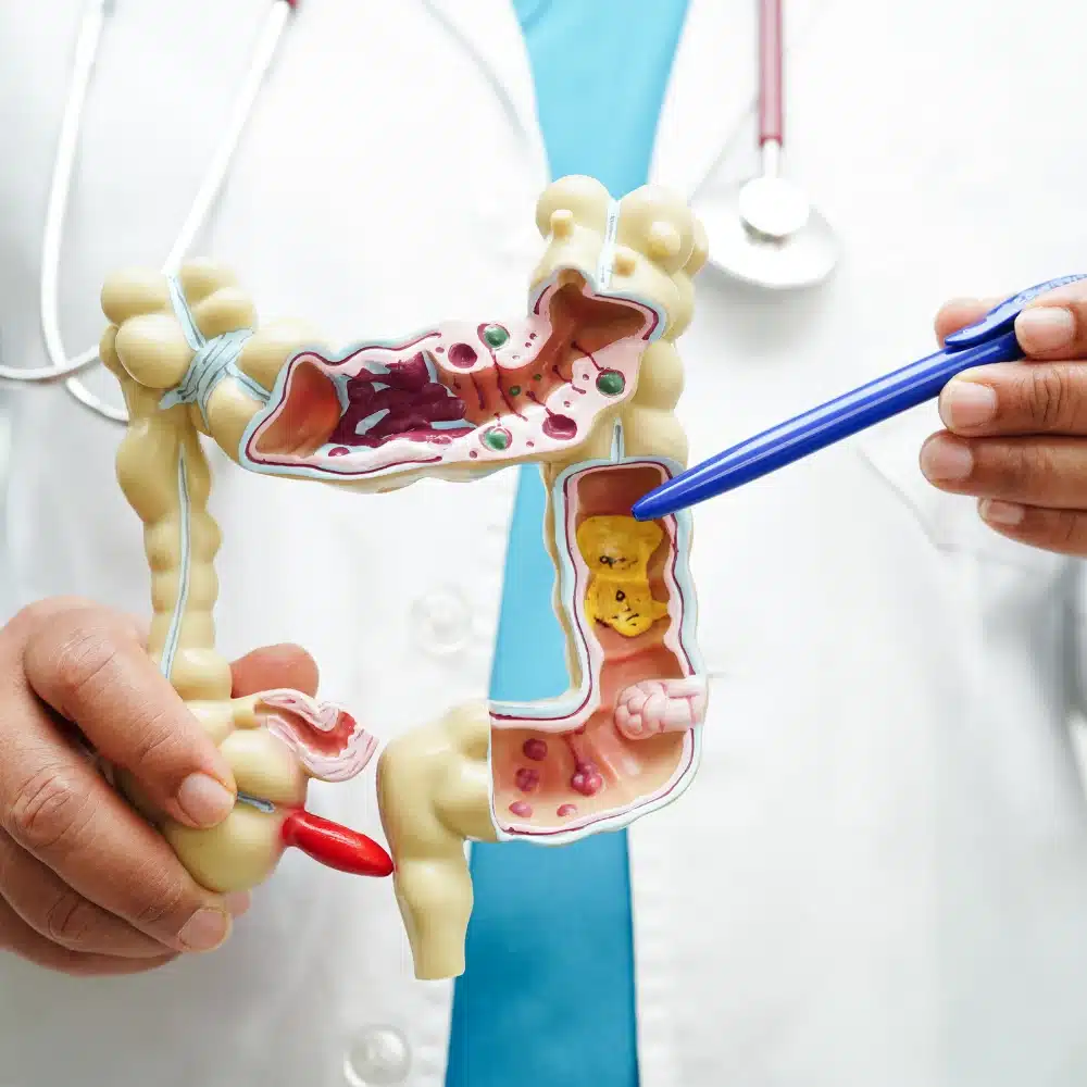 Understanding the Mind-Gut Connection_ Merus Gastros Comprehensive Approach to Gastrointestinal Health