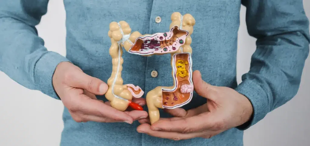 Crohn's Disease treatment specialist at Merus Gastroenterology in Suwanee GA