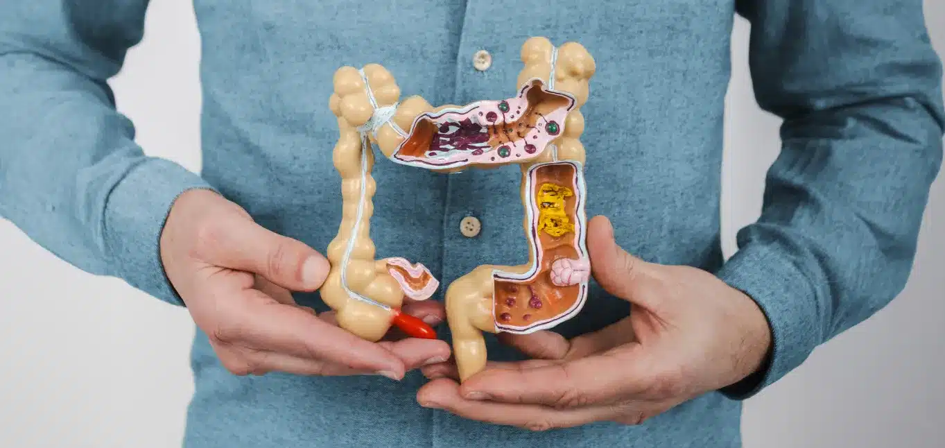 Crohn's Disease treatment specialist at Merus Gastroenterology in Suwanee GA