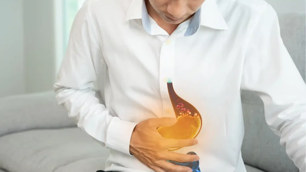 Acid Reflux and GERD Treatment in Connecticut How a GI Specialist Can Help You Find Relief
